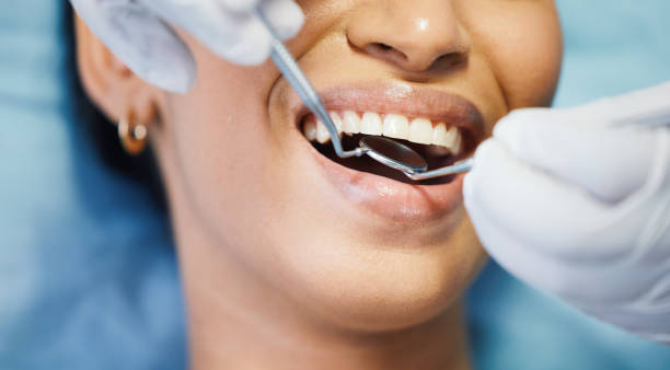 Best Pediatric Emergency Dentist in Merritt Island, FL